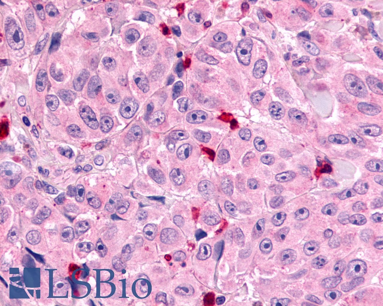 IHC-plus™ Polyclonal Rabbit anti-Human MRGX1 / MRGPRX1 Antibody (N-Terminus, IHC)