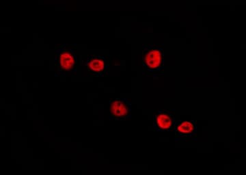 Polyclonal Rabbit anti-Human MAPK14 / p38 Antibody (phospho-Tyr323, IHC, IF, WB)