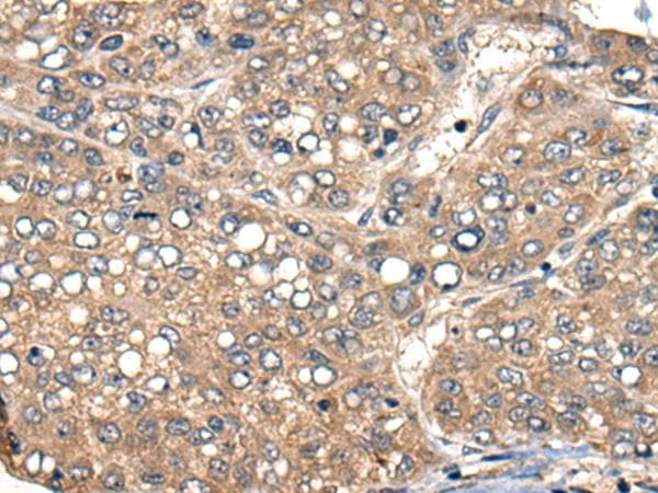 ACER1 / ASAH3 Antibody