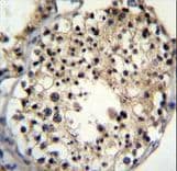 Polyclonal Rabbit anti-Human ALKBH6 Antibody (aa116-145, IHC, WB)