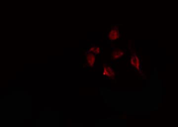 DDX20 / GEMIN3 Antibody
