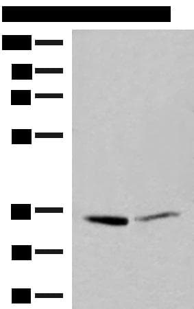 LDHA / LDH1 Antibody