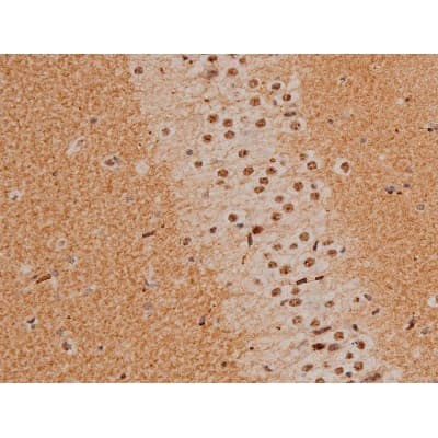 CREB1 / CREB Antibody (phospho-Ser133)