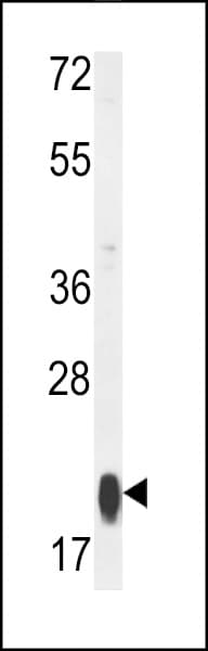 MRPS25 Antibody (aa145-173)