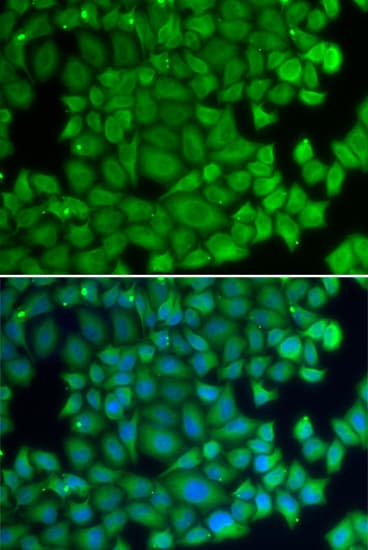 HSPB2 / HSP27 Antibody