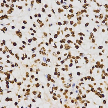 Histone H3 Antibody (Dimethyl-Lys27)