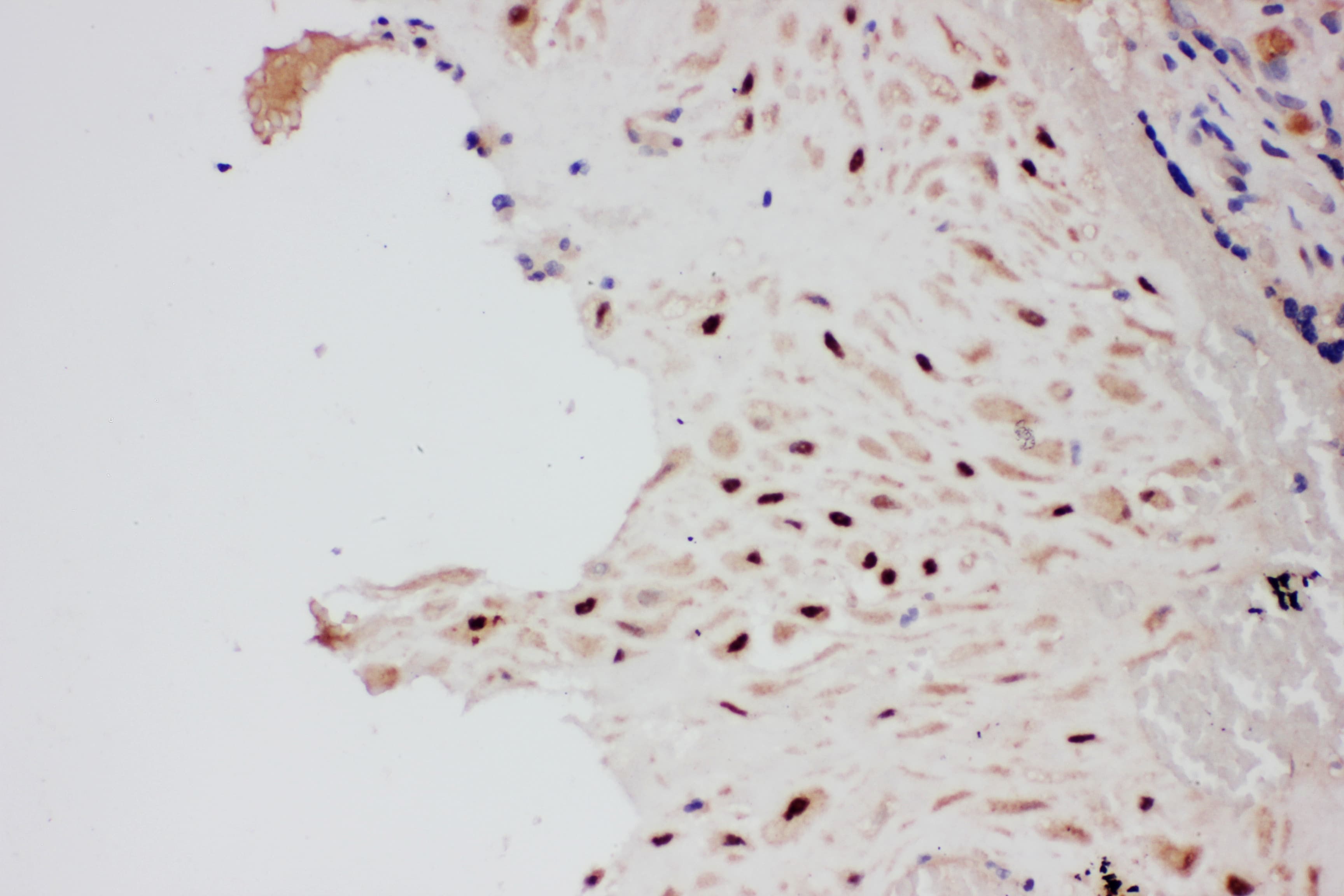 PIAS1 Antibody (aa636-651)