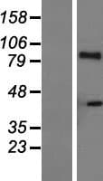 IL21 Receptor Protein (Over-Expression Lysate Myc-DDK (Flag))
