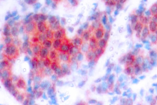 STAT4 Antibody (phospho-Tyr693)