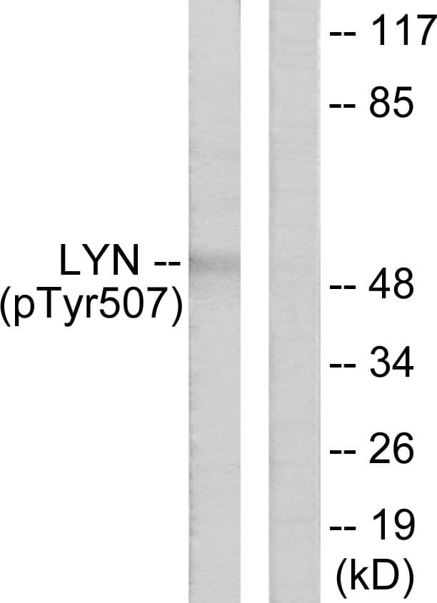 Polyclonal Rabbit anti-Human LYN Antibody (phospho-Tyr507, IHC, WB)