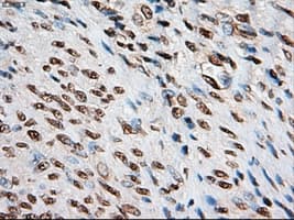 NOTCH1 Antibody (clone OTI3E12)