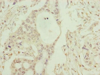 Complement C8b Antibody (aa55-350)