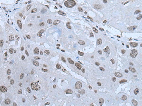 HAND1 Antibody