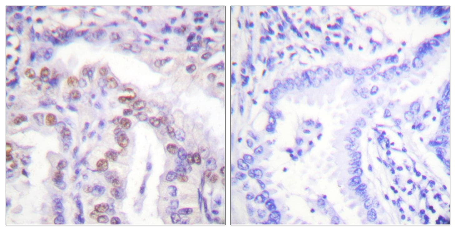 SENP6 Antibody