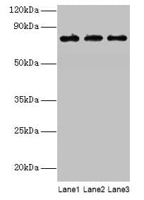 KIRREL2 / FILTRIN Antibody