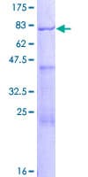 Human AAMP Protein (Recombinant GST)