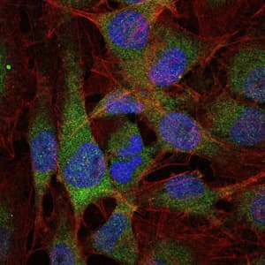 NFKB1 / NF-Kappa-B Antibody (clone 5D10D11)