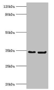 Rabies Virus Phosphoprotein Antibody