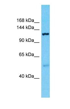 Polyclonal Rabbit anti-Human PDZD8 Antibody (C-Terminus, WB)