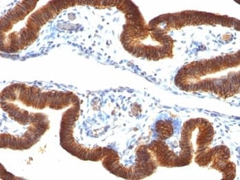 EPCAM Antibody (clone SPM134)