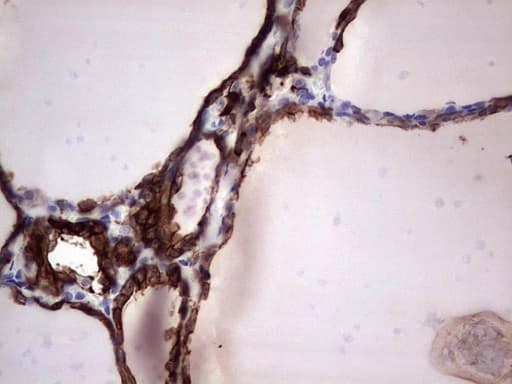 KRT19 / CK19 / Cytokeratin 19 Antibody (aa240-390, clone OTI5G7)