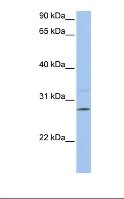 PEMT Antibody (C-Terminus)