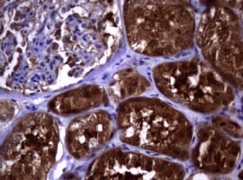 PIK3C2A Antibody (aa230-560, clone OTI2C11)