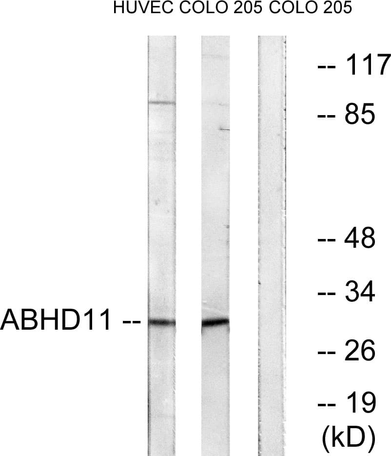 Polyclonal Rabbit anti-Human ABHD11 Antibody (aa161-210, WB)