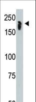N-CoR / NCOR1 Antibody (aa16-47)