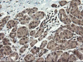 P3H1 / LEPRE1 Antibody (clone OTI1H3)