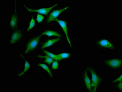 CABP4 Antibody