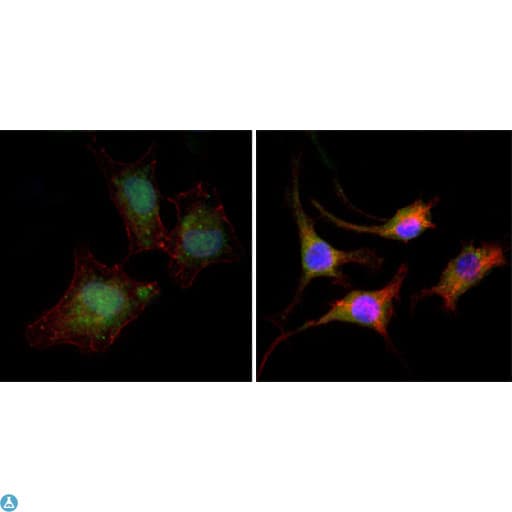 CTNNB1 / Beta Catenin Antibody