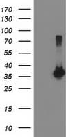 ARH / LDLRAP1 Antibody (clone OTI2B2)