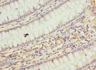 TAF12 Antibody