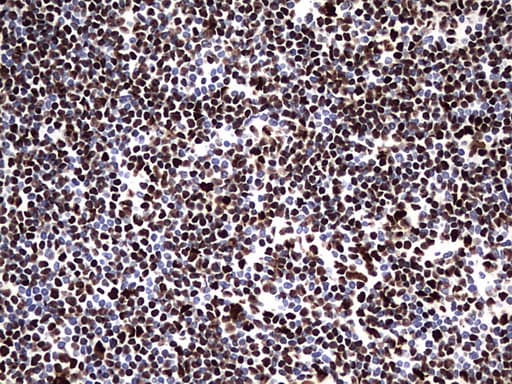 HNRPM / HNRNPM Antibody (aa1-261, clone OTI4C9)
