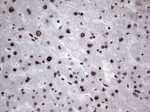 HNRNPL / hnRNP L Antibody (aa270-502, clone OTI2E4)