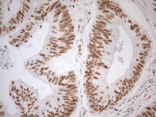 Monoclonal Mouse anti-Human WTAP Antibody (clone OTI12G7, aa2-106, IHC, WB)