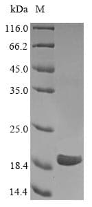 Human CTAG1A + CTAG1B Protein (Recombinant 10His, N-terminus)