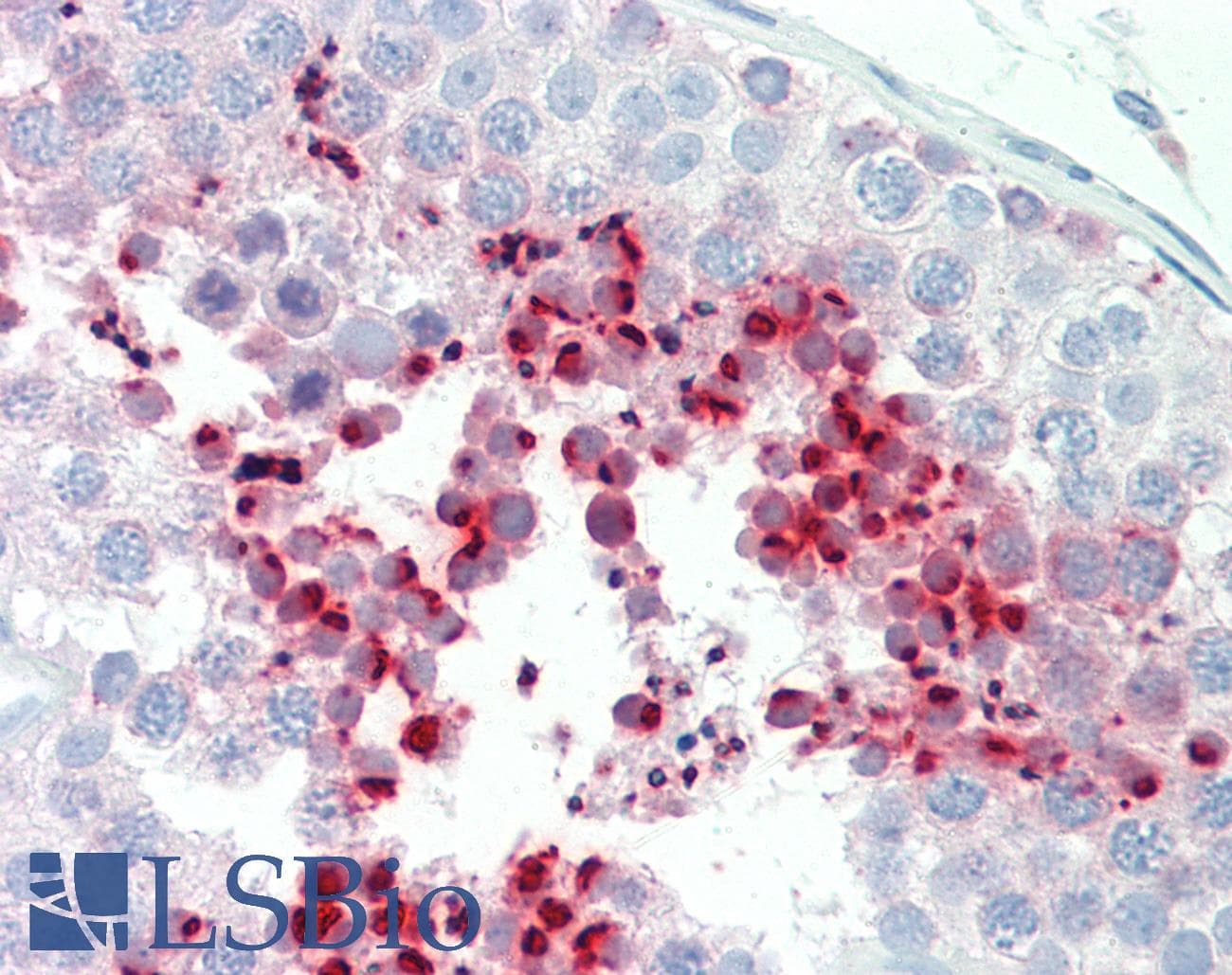 IHC-plus™ Polyclonal Rabbit anti-Human ADCY1 / Adenylate Cyclase 1 Antibody (aa231-280, IHC, WB)