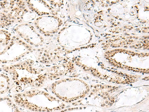 FKBP5 / FKBP51 Antibody