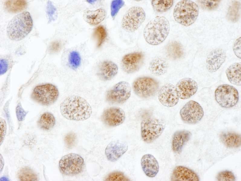 Polyclonal Rabbit anti-Human CTR9 Antibody (aa1123-1173, IHC)