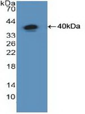 NFKB1 / NF-Kappa-B Antibody (aa805-892)