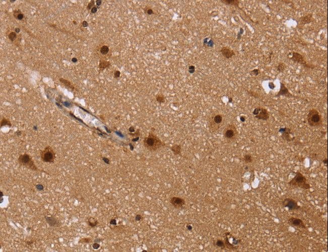 FASTKD5 Antibody