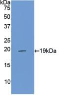 PROCR / EPCR Antibody (aa59-217)