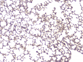 Polyclonal Rabbit anti-Human BMP15 Antibody (IHC, WB)