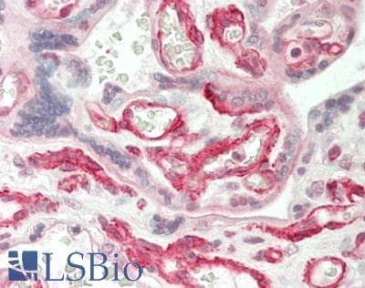 IHC-plus™ ANGPTL3 Antibody (Fibrogen-like domain)