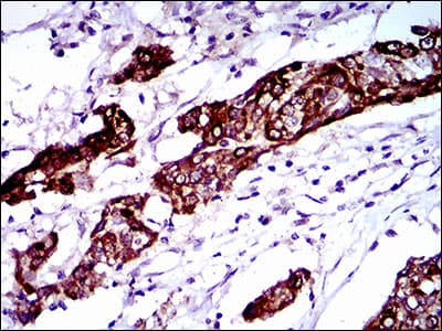 Monoclonal Mouse anti-Human BRCA1 Antibody (clone 6C6D2, aa229-335, IHC, WB)