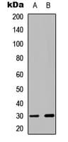 CDK5 Antibody (phospho-Tyr15)