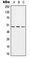 Polyclonal Rabbit anti-Human CHST1 Antibody (Internal, WB)