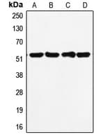 TP53 / p53 Antibody (C-Terminus)